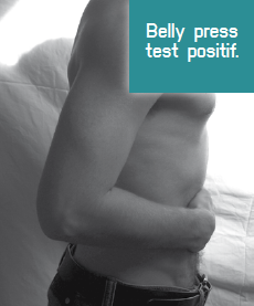 <p>Belly Press test positif (noter la rétropulsion du coude et la flexion du poignet).</p>
