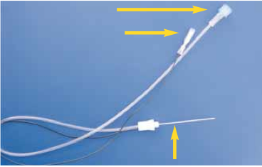 <div title="Page 2">
<div>
<div>
<div>
<p>Les aiguilles répondent à une double finalité (électrique et infiltratoire).</p>
</div>
</div>
</div>
</div>
