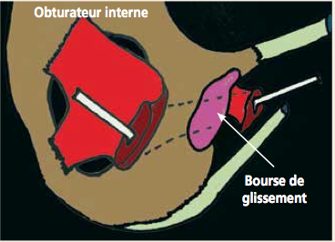 <p>Bursite lors du passage de l’obturateur interne contre l’échancrure.</p>
